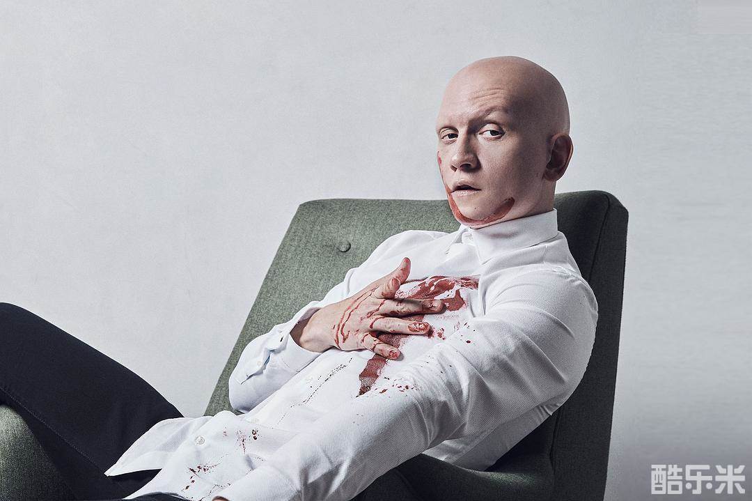 安东尼·卡里根